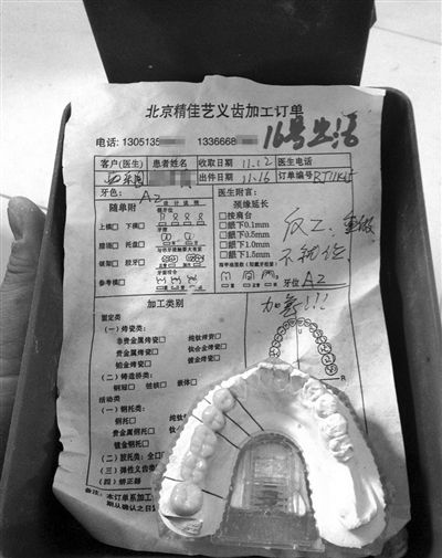 精佳艺义齿加工订单显示"反(返)工,重做"等字样,一名骨干业务员说,该