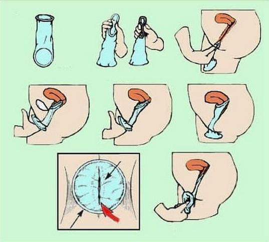 避孕套使用量排行:世界中国居首 国内江苏第一(组图)