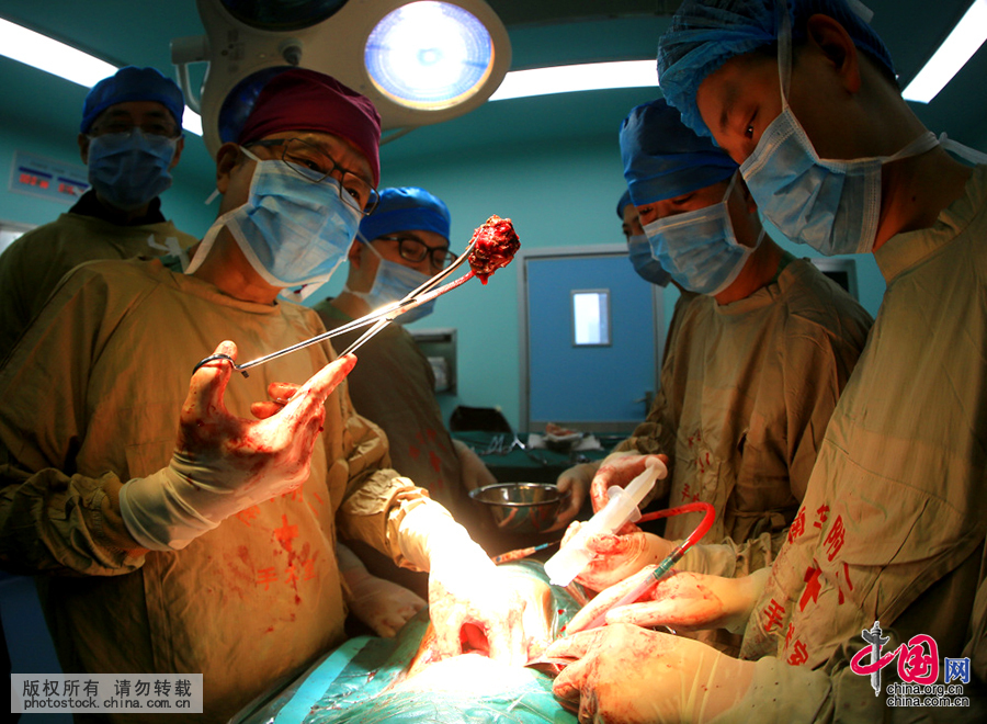 【中国故事】外科医生罗志刚的“on call 24小时”