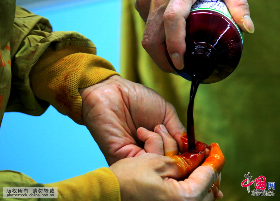 【中国故事】外科医生罗志刚的“on call 24小时”