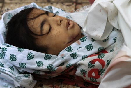 The body of a 12-year-old Palestinian girl killed during Israeli military operations in Tal al Hawa area lies at a mortuary in Gaza City, on January 16, 2009. The death toll in Gaza has risen to more than 1140 since the beginning of the Israeli massive attack on Gaza on December 27, 2008, with about 5150 wounded, Gaza emergency chief Mo'aweya Hassanein said on Friday. [Xinhua]