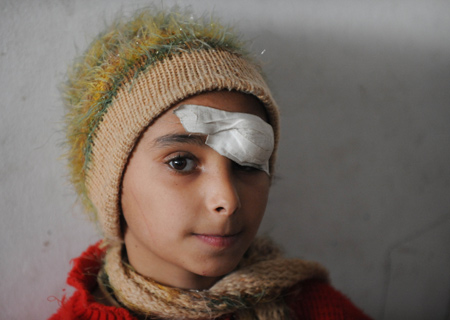 A Palestinian girl whose left eye was injured during an Israeli offensive is seen in the southern Gaza Strip,on January 26, 2009. More than 400 Palestinian children were killed and about 50,000 others became destitute and homeless in the 22-day Israeli military attacks on the Gaza Strip since December 27, 2008. [Xinhua]