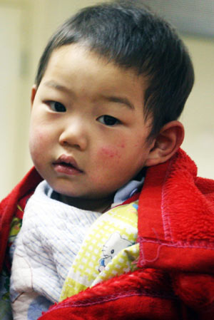 Li Rui, the 2-year-old leukemia-afflicted kid, waits for medical check-up and treatment at the Beijing Children's Hospital in Beijing, China's capital, on February 17, 2009. 