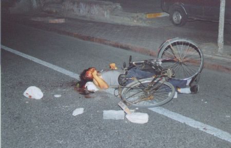 File photo released by the government of Urumqi City in a press conference in Urumqi, capital of northwest China's Xinjiang Uygur Autonomous Region, on July 7, 2009, shows a victim of the riot. 