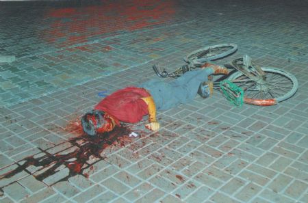 File photo released by the government of Urumqi City in a press conference in Urumqi, capital of northwest China's Xinjiang Uygur Autonomous Region, on July 7, 2009, shows a victim of the riot. 