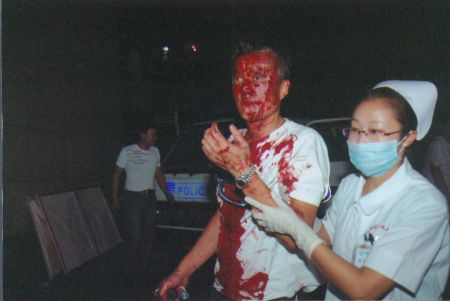 File photo released by the government of Urumqi City in a press conference in Urumqi, capital of northwest China's Xinjiang Uygur Autonomous Region, on July 7, 2009, shows a medical worker taking care of a man injured in the riot.