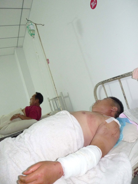 Injured people receive medical treatment in hospital in Yanshi City, central China's Henan Province, on July 15, 2009. A blast occurred at the Luoran chemical plant on early Wednesday morning, which was followed by a fire. The blast caused at least four people dead and more than 100 others injured. The investigation of the accident was underway.