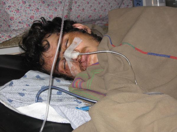 An injured man is treated in a local hospital in Kandahar, Afghanistan, on Jan. 16, 2011. 