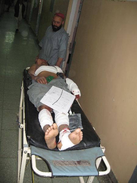 An injured man is treated in a local hospital in Kandahar, Afghanistan, on Jan. 16, 2011. 