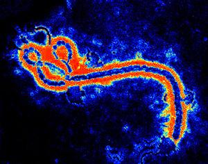 Ebola virus. [Photo: news.yixue.org]