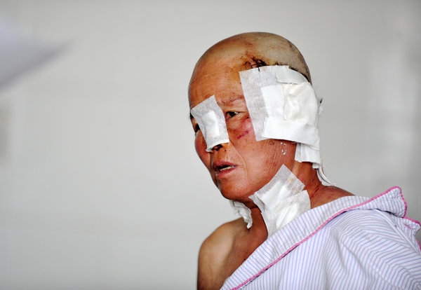 A man injured in a wolf attack receives treatment at a hospital, Aug 12, 2014.