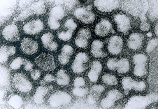 Influenza A virus, one of the 'Top 10 deadly viruses in the world' by China.org.cn.