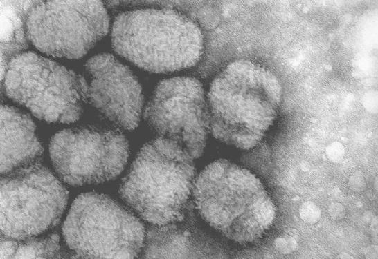 Smallpox, one of the 'Top 10 deadly viruses in the world' by China.org.cn.